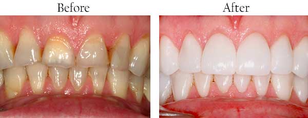 94025 Dental Images